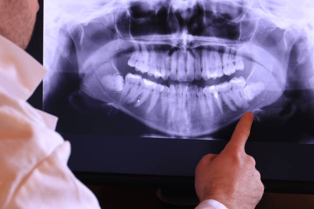 Best Emergency Dentist for Lost Fillings or Crowns in Forestbrook, SC
