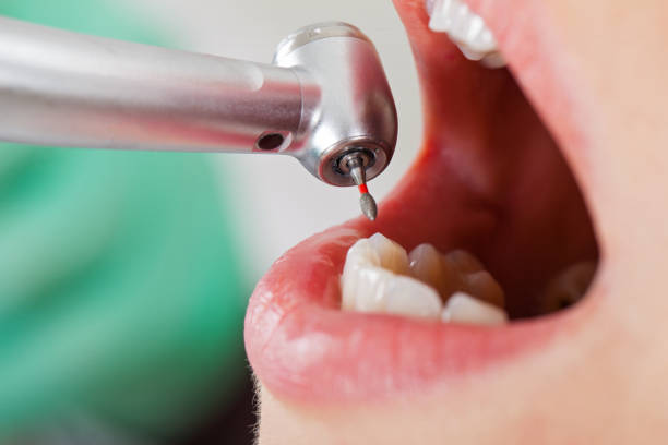 Best Emergency Dental Extractions in Forestbrook, SC